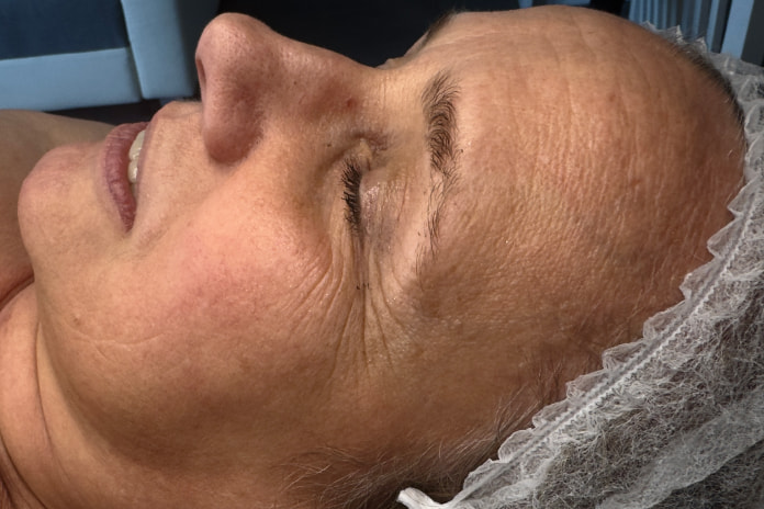 Skin condition before cosmetology therapy at SkinCareWithMargo